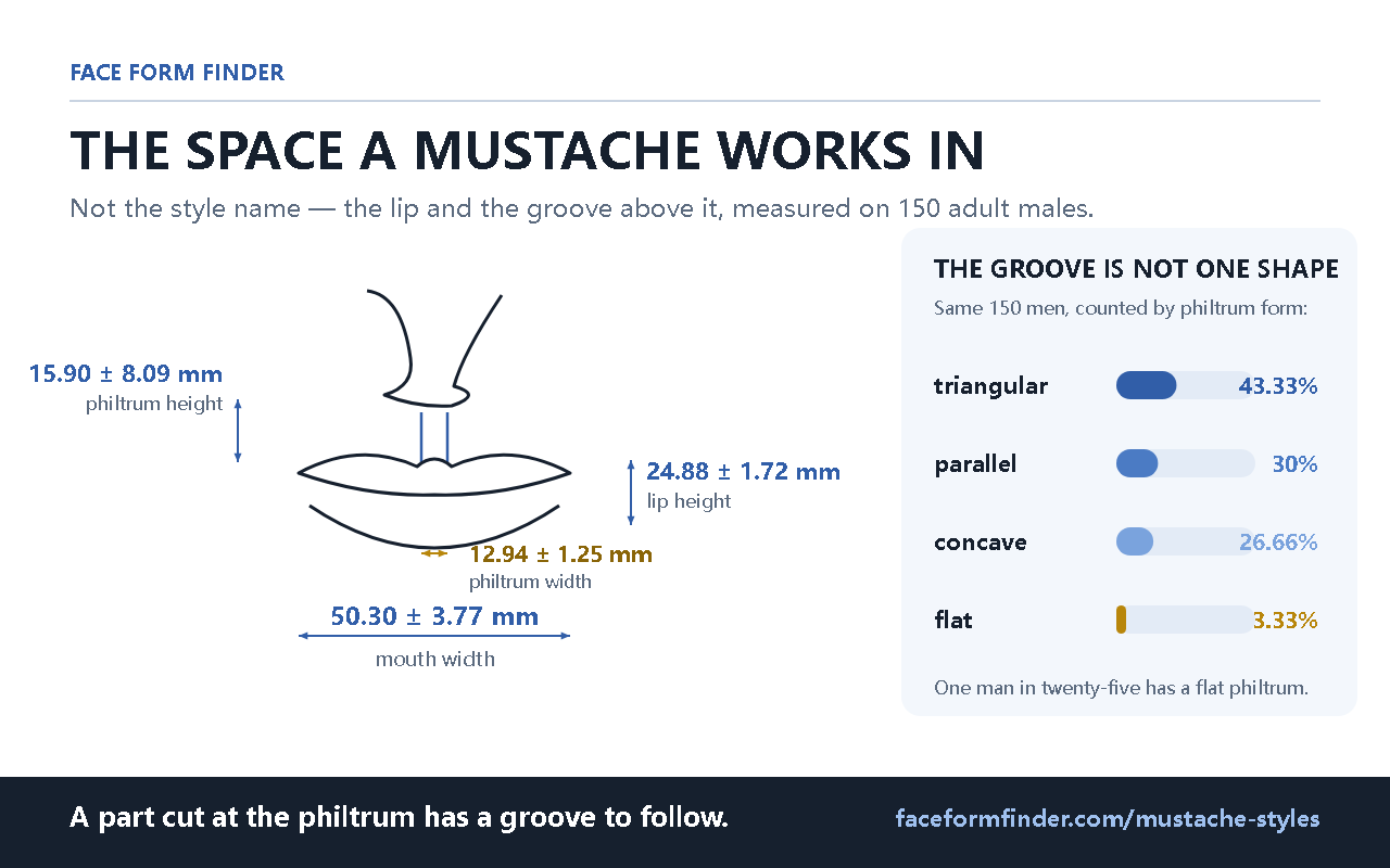 Front view of a nose and lips with four measured distances labelled in millimetres, and a bar chart of the four philtrum forms counted in the same group of men.
